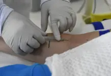 SES divulga nota reforçando vigilância e MS segue sem casos confirmados de hantavirose há 7 anos
